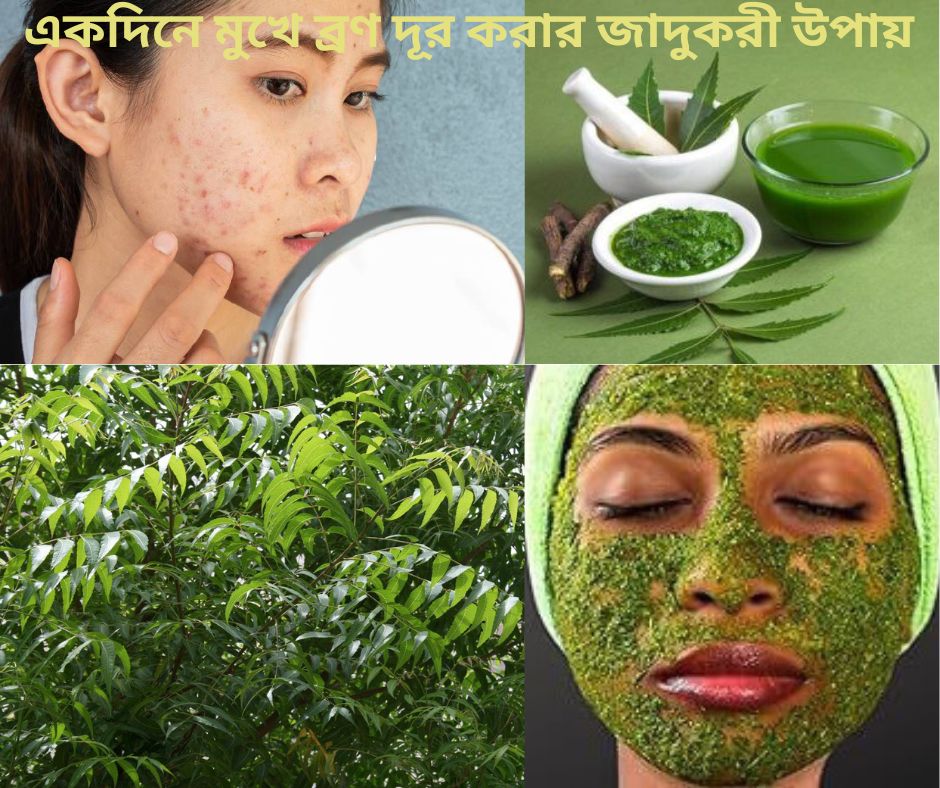 একদিনে মুখে ব্রণ দূর করার জাদুকরী উপায়